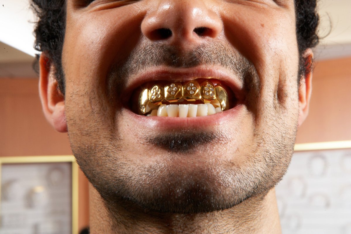 Улыбка с золотыми зубами